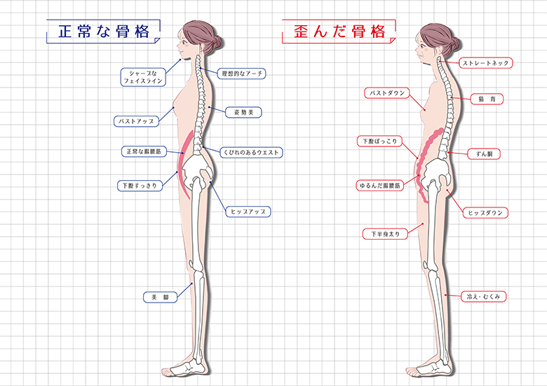 歪んだ体の比較図